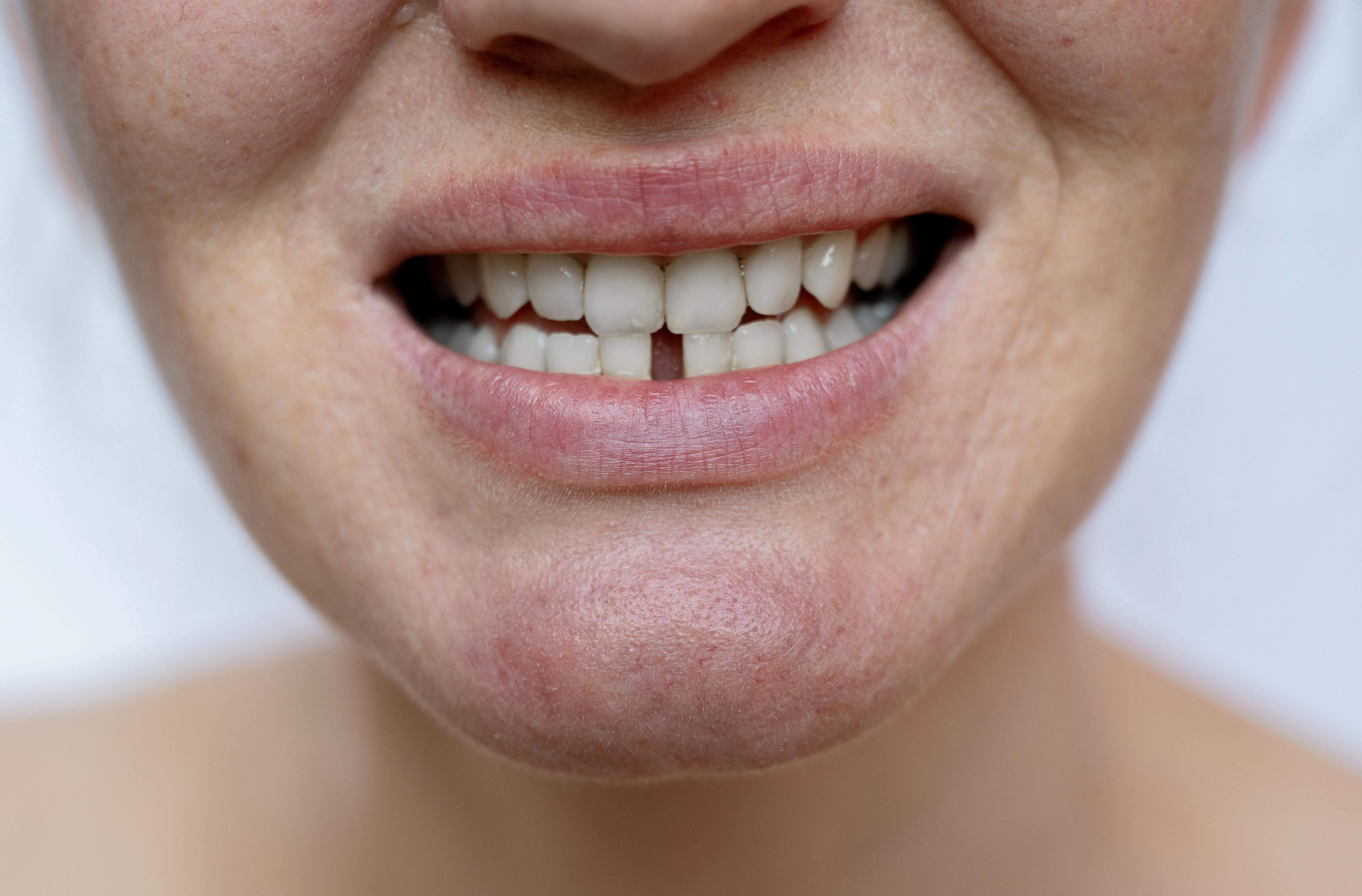 KIA Dental treatment